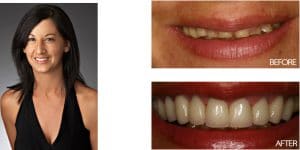 Cosmetic Dentist - Dental 359 Subiaco