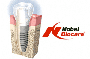 image clearly showing what a dental implant looks like
